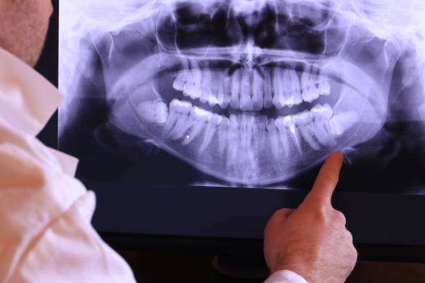 Best Broken or Chipped Tooth Repair in Baldwin City, KS