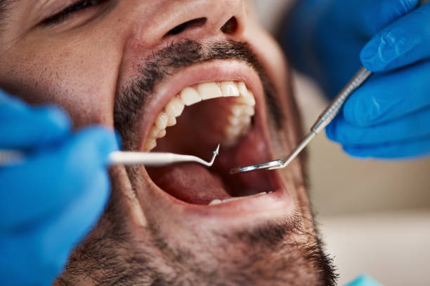Best Emergency Treatment for Oral Infections in Baldwin City, KS